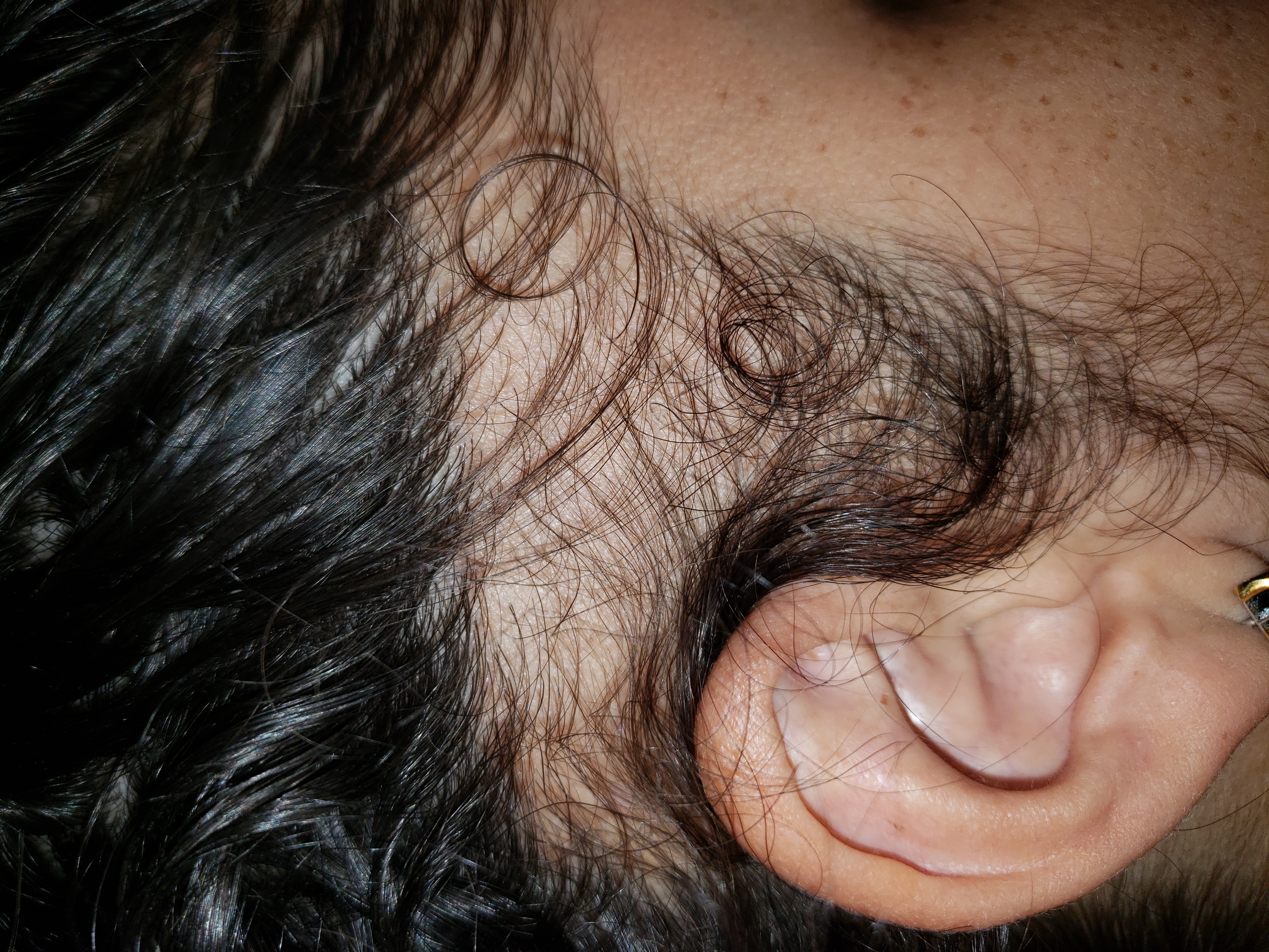 Detalle del cabello y cuero cabelludo