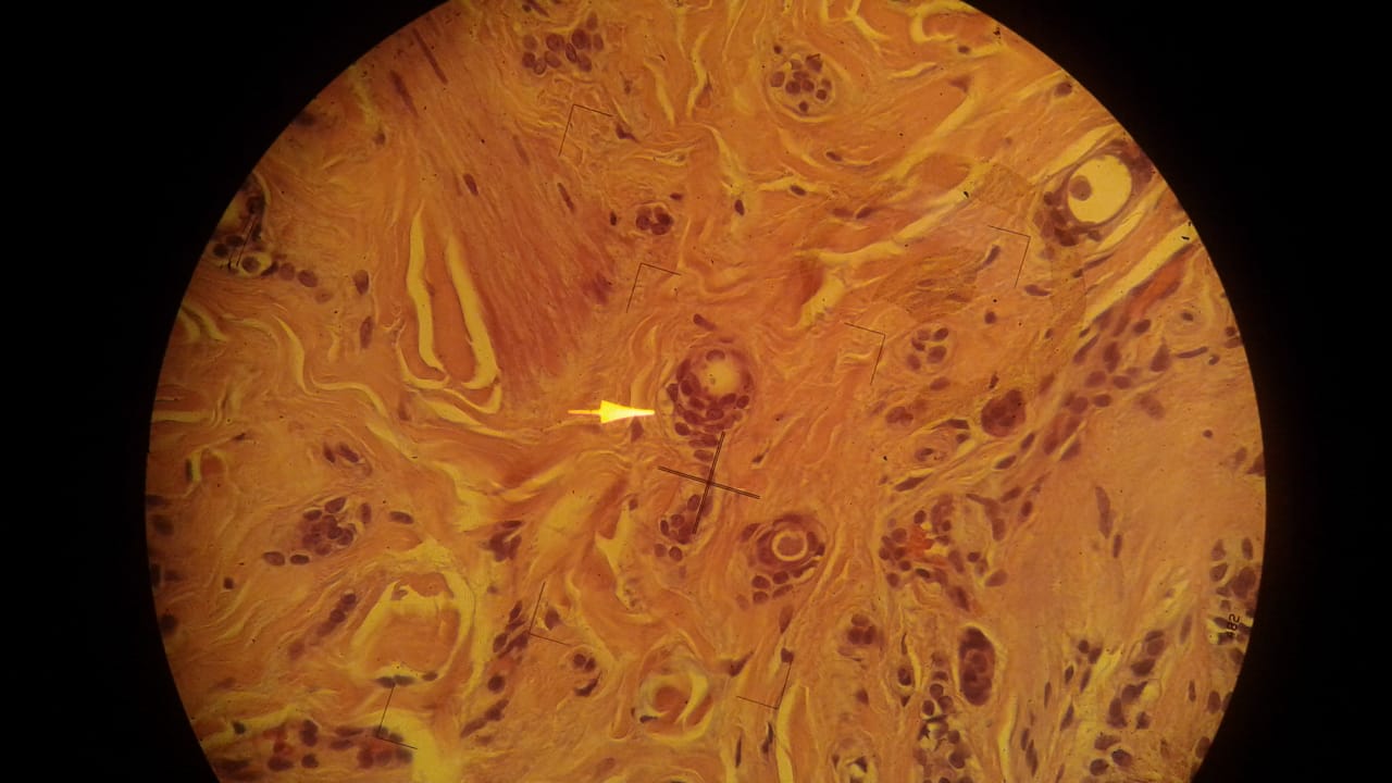 Imagen microscópica de una muestra