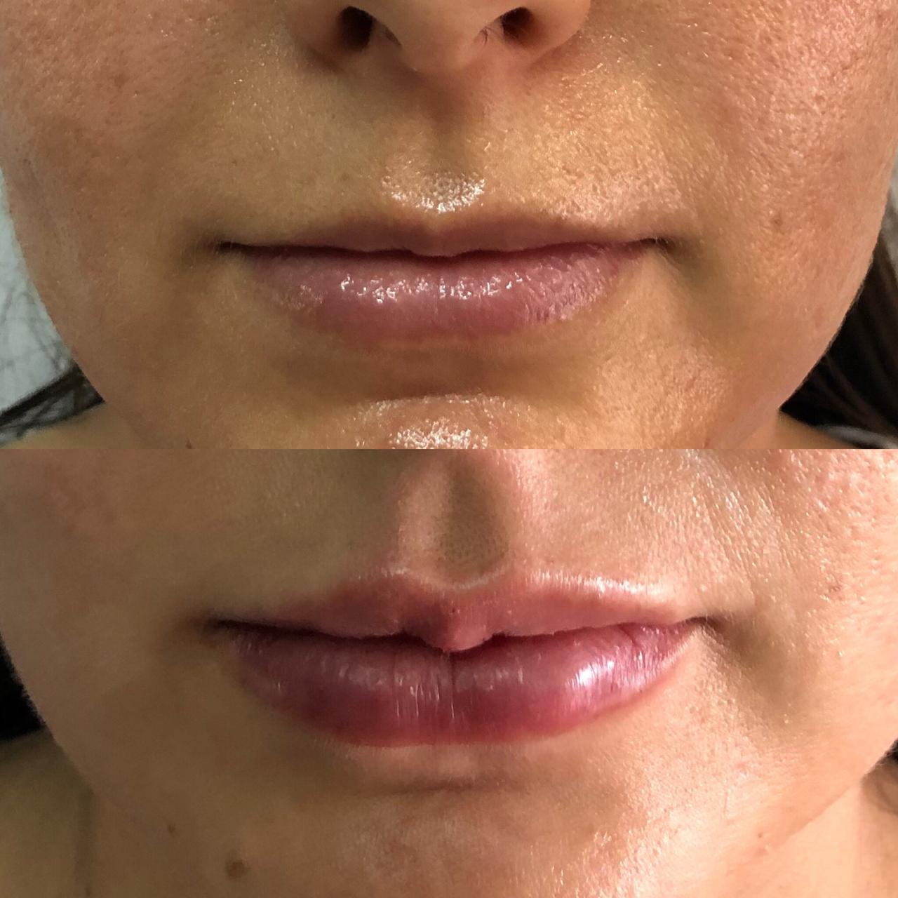 Dos fotografías de labios